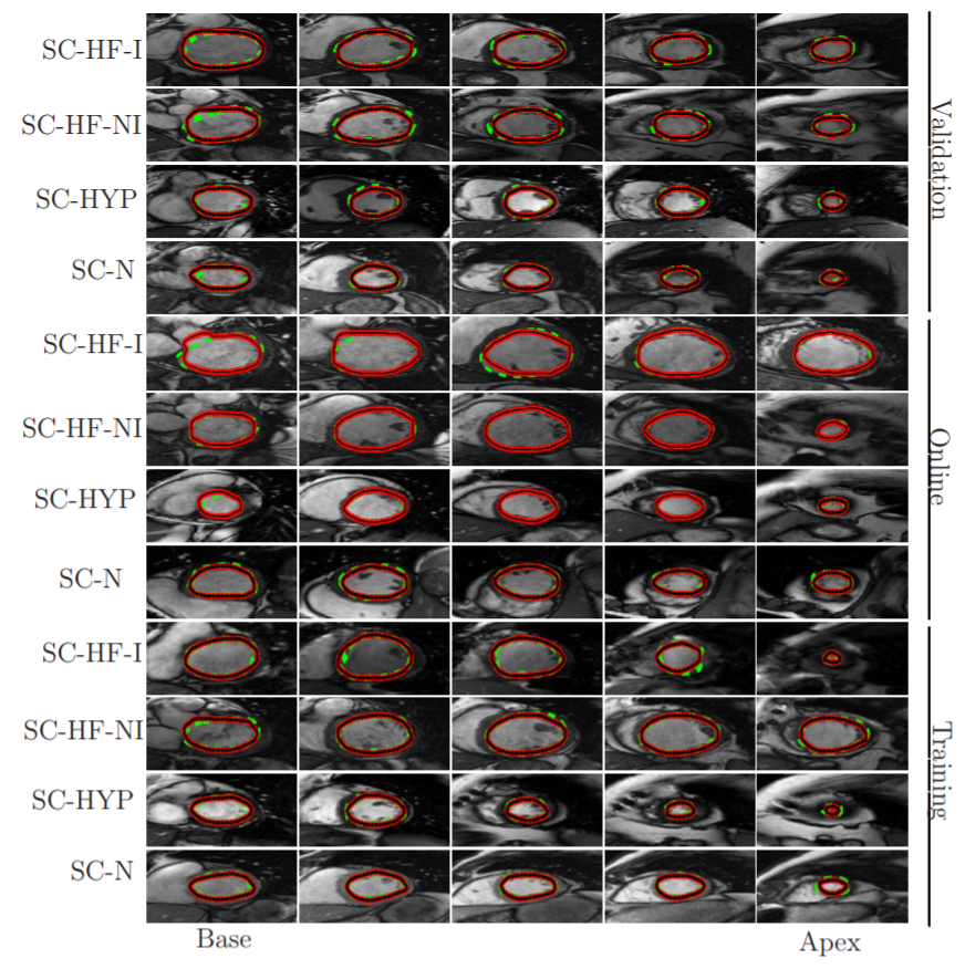 A Combined Deep-Learning and Deformable-Model Approach to Fully Automatic Segmentation of the Left Ventricle in Cardiac MRI